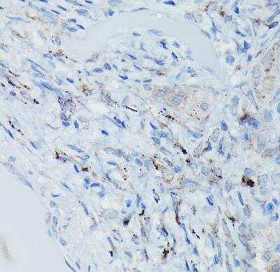 Immunohistochemistry-Paraffin: Dfna5 Antibody - Azide and BSA Free [NBP2-92914]