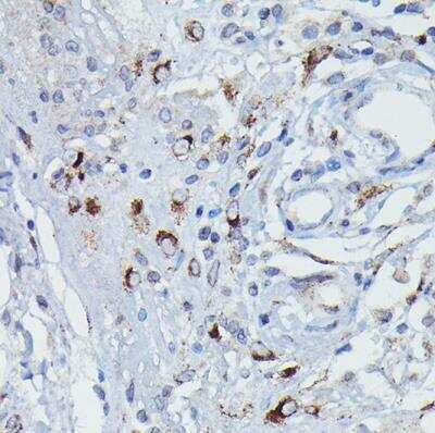 Immunohistochemistry-Paraffin: Dfna5 Antibody - Azide and BSA Free [NBP2-92914]