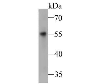 Western Blot: Dfna5 Antibody [NBP2-80426]