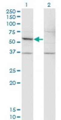 Western Blot: Dfna5 Antibody (1E10) [H00001687-M01]