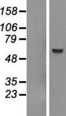 Western Blot: Dfna5 Overexpression Lysate [NBP2-11376]