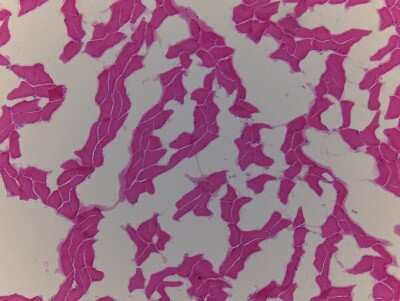 Hematoxylin & Eosin Stain: Diaphragm Tissue Slides (Adult Normal)- Frozen [NBP2-77577]
