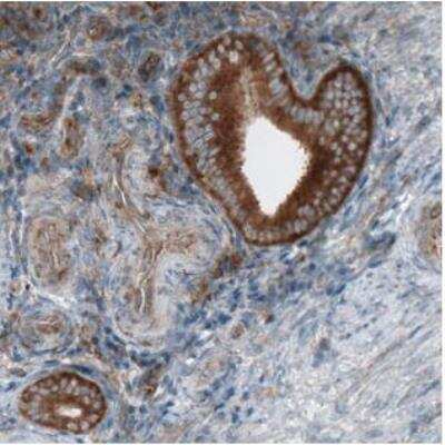 Immunohistochemistry-Paraffin: Dicer Antibody (CL0378) [NBP2-30699]