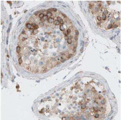 Immunohistochemistry-Paraffin: Dicer Antibody (CL0378) [NBP2-30699]