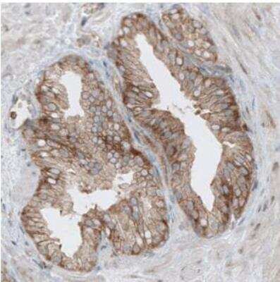 Immunohistochemistry-Paraffin: Dicer Antibody (CL0378) [NBP2-30699]