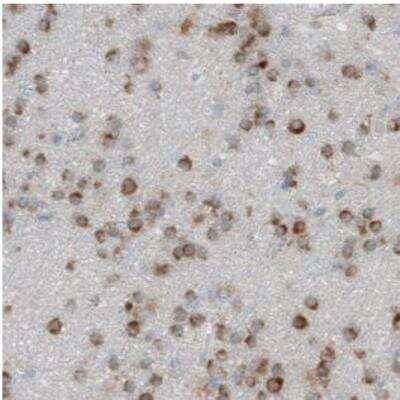 Immunohistochemistry-Paraffin: Dicer Antibody (CL0378) [NBP2-30699]