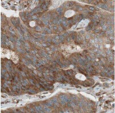 Immunohistochemistry-Paraffin: Dicer Antibody (CL0378) [NBP2-30699]