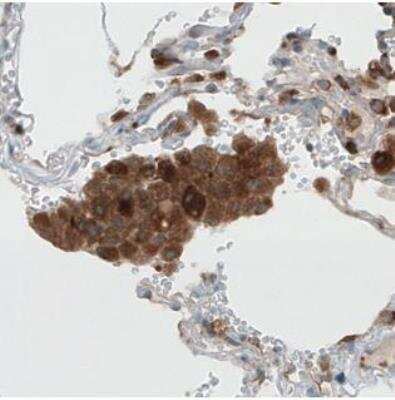 Immunohistochemistry-Paraffin: Dicer Antibody (CL0378) [NBP2-30699]