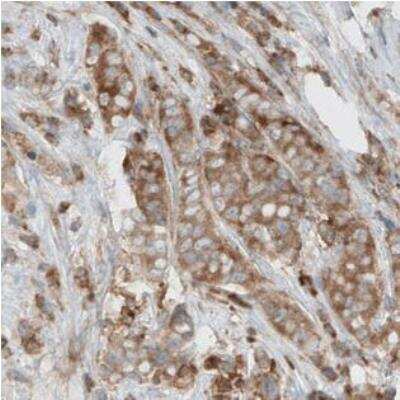 Immunohistochemistry-Paraffin: Dicer Antibody (CL0378) [NBP2-30699]