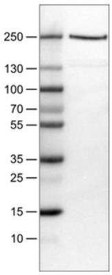Western Blot: Dicer Antibody (CL0378) [NBP2-30699]