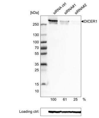 Western Blot: Dicer Antibody (CL0378) [NBP2-30699]