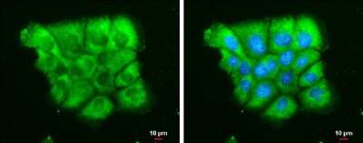 Immunocytochemistry/ Immunofluorescence: Dicer Antibody (GT1176) [NBP3-13572]