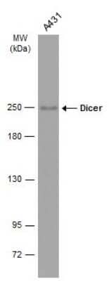 Western Blot: Dicer Antibody (GT1176) [NBP3-13572]