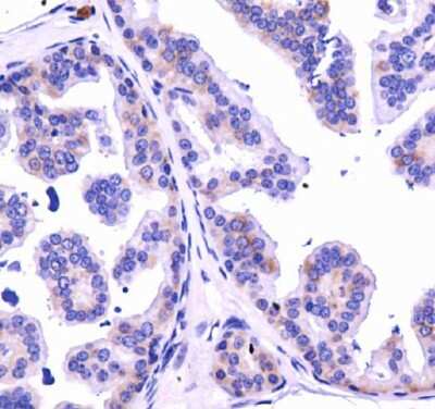 Immunohistochemistry: Dicer Antibody - BSA Free [NBP1-71691]