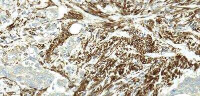 Immunohistochemistry-Paraffin: Dicer Antibody - BSA Free [NBP1-71691]