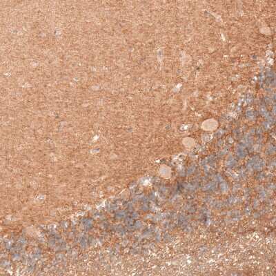 Immunohistochemistry-Paraffin: Dicer Antibody [NBP1-85213]