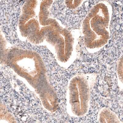 Immunohistochemistry-Paraffin: Dicer Antibody [NBP1-85213]