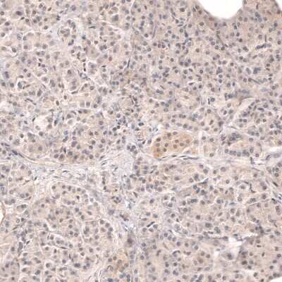 Immunohistochemistry-Paraffin: Dicer Antibody [NBP1-85213]