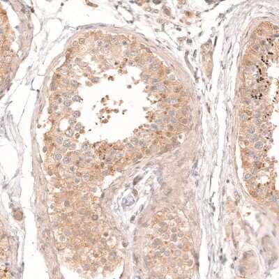 Immunohistochemistry-Paraffin: Dicer Antibody [NBP1-85213]