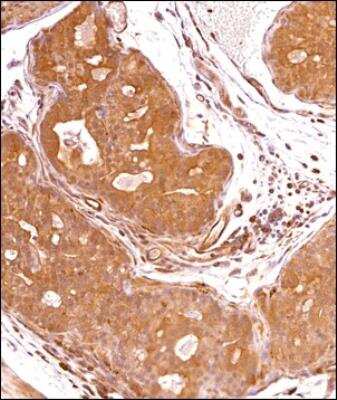 Immunohistochemistry-Paraffin: Dicer Antibody - BSA Free [NBP2-88949]