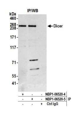 Immunoprecipitation: Dicer Antibody [NBP1-06520]
