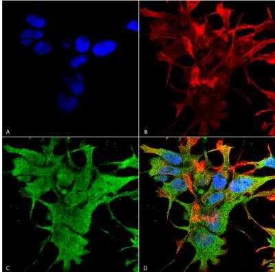 Immunocytochemistry/ Immunofluorescence: Dicer Antibody (S167-7) [NBP2-22415]