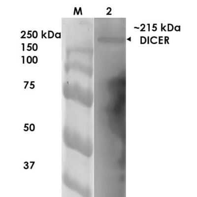 Western Blot: Dicer Antibody (S167-7) [NBP2-22415]