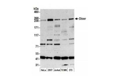 Western Blot: Dicer Antibody [NBP1-06520]