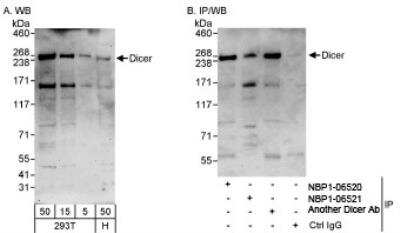 Western Blot: Dicer Antibody [NBP1-06521]