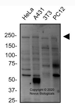 Western Blot: Dicer AntibodyBSA Free [NBP2-88949]