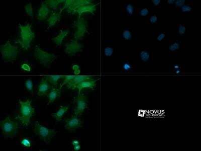 Immunocytochemistry/ Immunofluorescence: Dicer knockout Mouse embryonic stem cells [NBP1-96751]