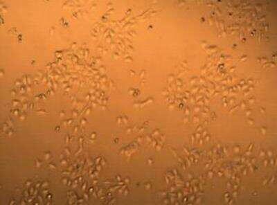 Immunohistochemistry: Dicer knockout Mouse embryonic stem cells [NBP1-96751]