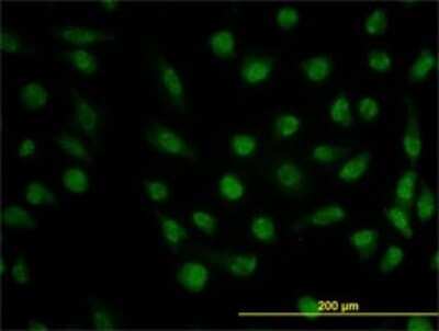 Immunocytochemistry/ Immunofluorescence: Dihydrofolate Reductase/DHFR Antibody (2B10) [H00001719-M01]