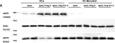 Western Blot: Dihydrofolate Reductase/DHFR Antibody (2B10) [H00001719-M01]