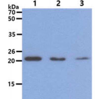 Western Blot: Dihydrofolate Reductase/DHFR Antibody (5B2)BSA Free [NBP2-59464]