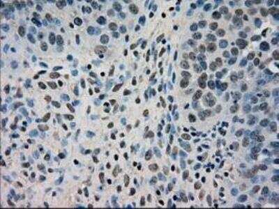 Immunohistochemistry-Paraffin: Dihydrofolate Reductase/DHFR Antibody (OTI6G7) [NBP1-47727]