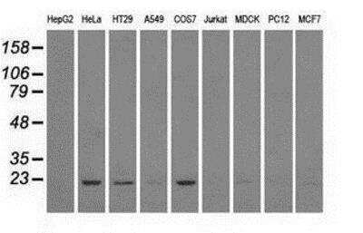 Western Blot: Dihydrofolate Reductase/DHFR Antibody (OTI6G7) [NBP1-47727]