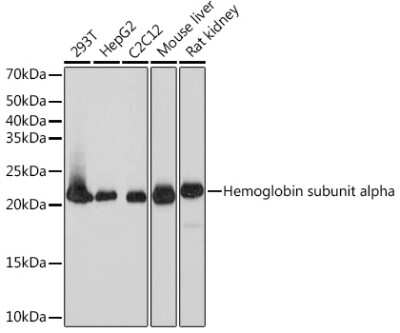 Western Blot: Dihydrofolate Reductase/DHFR Antibody (7N3X4) [NBP3-16805]