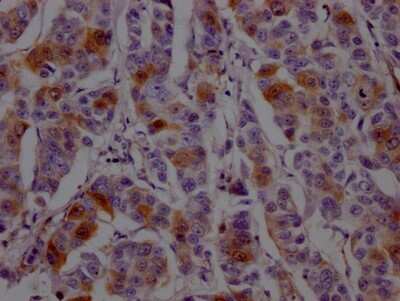 Immunohistochemistry: Dihydrofolate Reductase/DHFR Antibody (9B2) [NBP3-15195]