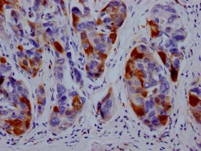 Immunohistochemistry: Dihydrofolate Reductase/DHFR Antibody (9B2) [NBP3-15195]