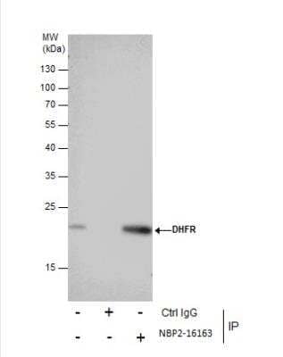 Immunoprecipitation: Dihydrofolate Reductase/DHFR Antibody [NBP2-16163]