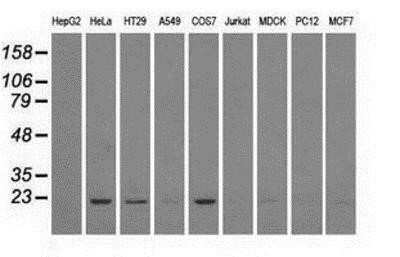 Western Blot: Dihydrofolate Reductase/DHFR Antibody (OTI6G7)Azide and BSA Free [NBP2-70569]
