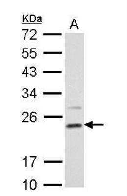 Western Blot: Dihydrofolate Reductase/DHFR Antibody [NBP2-16163]