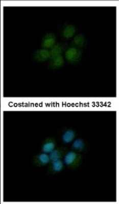 Immunocytochemistry/ Immunofluorescence: Dihydrofolate Reductase/DHFR Antibody [NBP2-16163]
