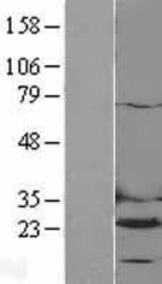 Western Blot: Dihydrofolate Reductase/DHFR Overexpression Lysate [NBL1-09860]