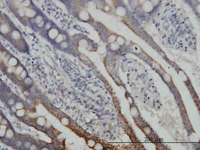 Immunohistochemistry-Paraffin: Dihydrolipoamide Dehydrogenase/DLD Antibody (1G11) [H00001738-M04]