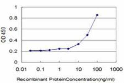 ELISA: Dihydrolipoamide Dehydrogenase/DLD Antibody (2D4) [H00001738-M05]