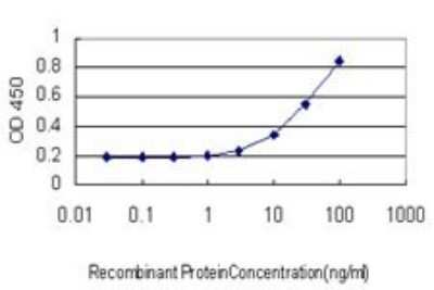 ELISA: Dihydrolipoamide Dehydrogenase/DLD Antibody (3C1) [H00001738-M02]