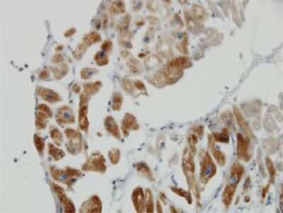 Immunohistochemistry-Paraffin: Dihydrolipoamide Dehydrogenase/DLD Antibody (3C1) [H00001738-M02]