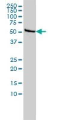 Western Blot: Dihydrolipoamide Dehydrogenase/DLD Antibody (3C1) [H00001738-M02]